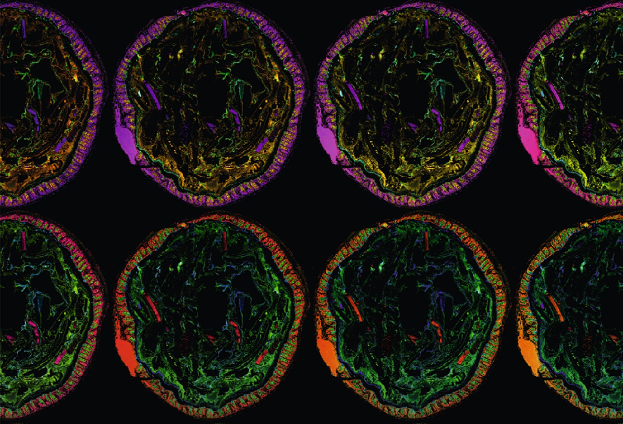 Gut microbiome dysbiosis linked with recurrent UTIs post image